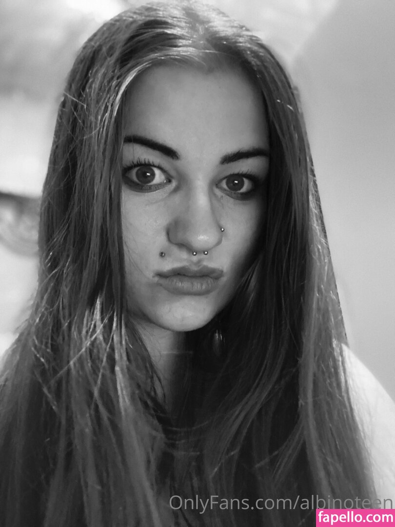 albinoteen-1