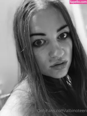 albinoteen thumbnail #3150803
