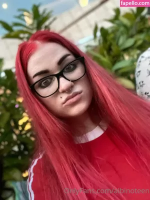 albinoteen thumbnail #3150799