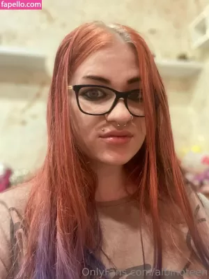 albinoteen thumbnail #3150796