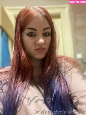 albinoteen thumbnail #3150795